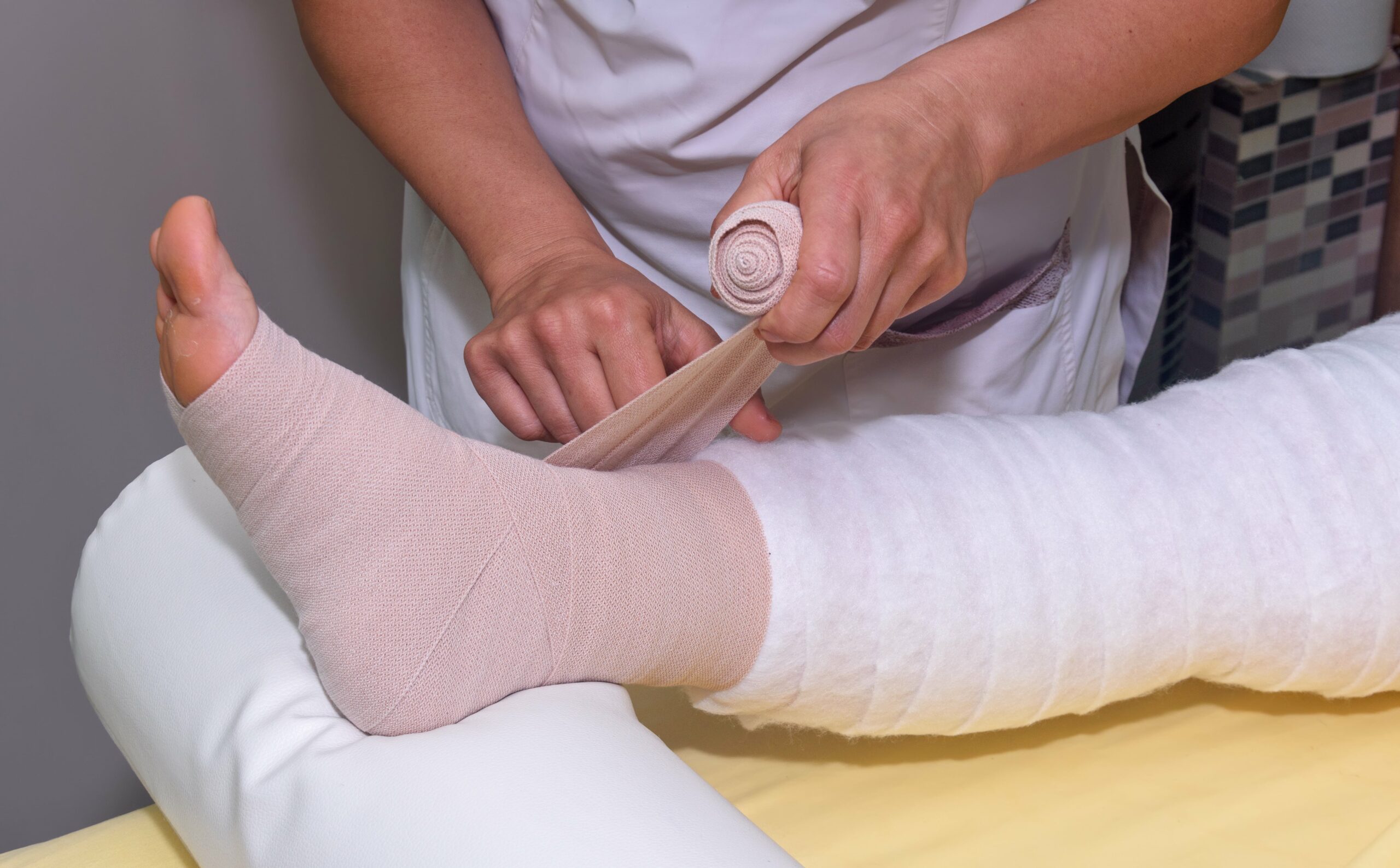 wound care specialist bandaging a leg with lymphedema