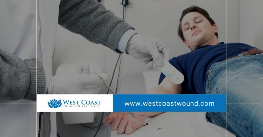 wound care