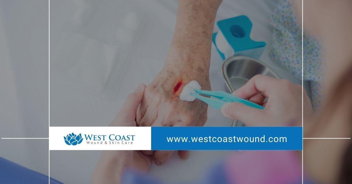 treatment for wounds