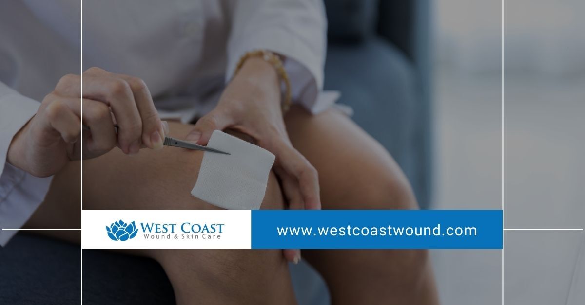 wound care centers wound care centers