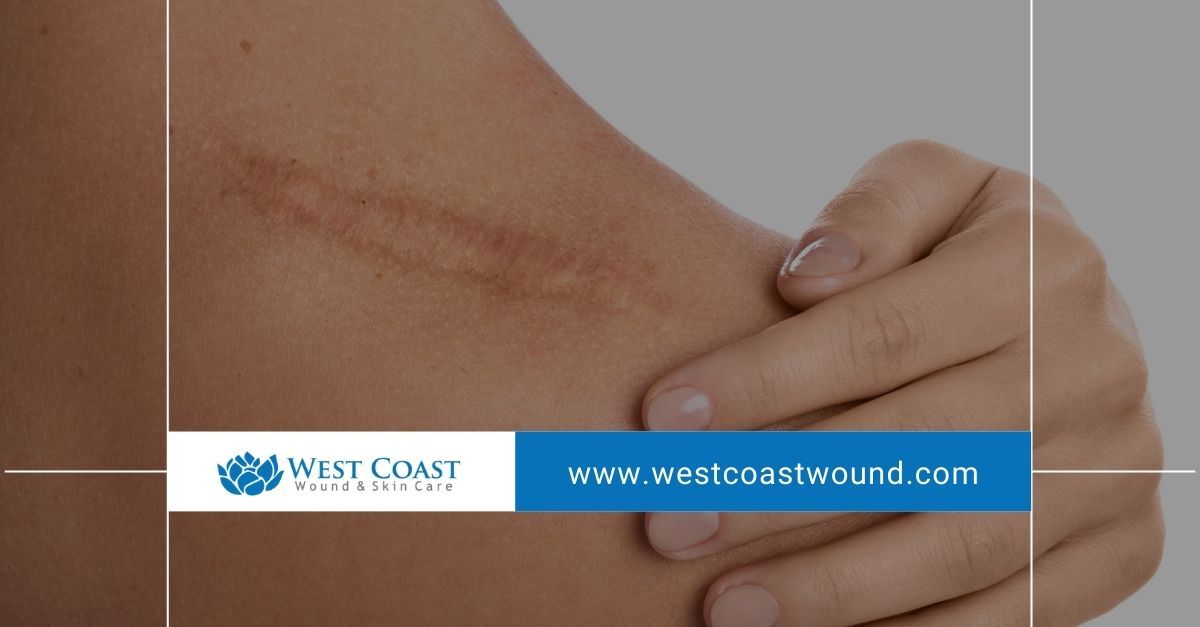 Wound Care Specialists