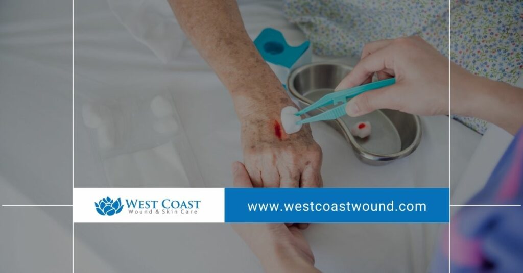 Wound Care Services