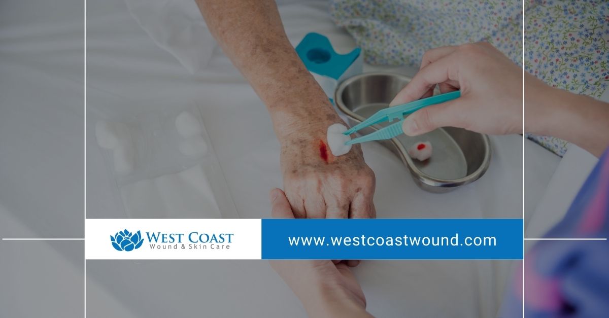 Wound Care Services 