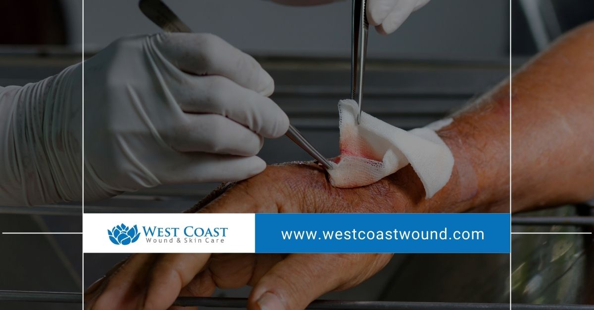 wound care in tuscon