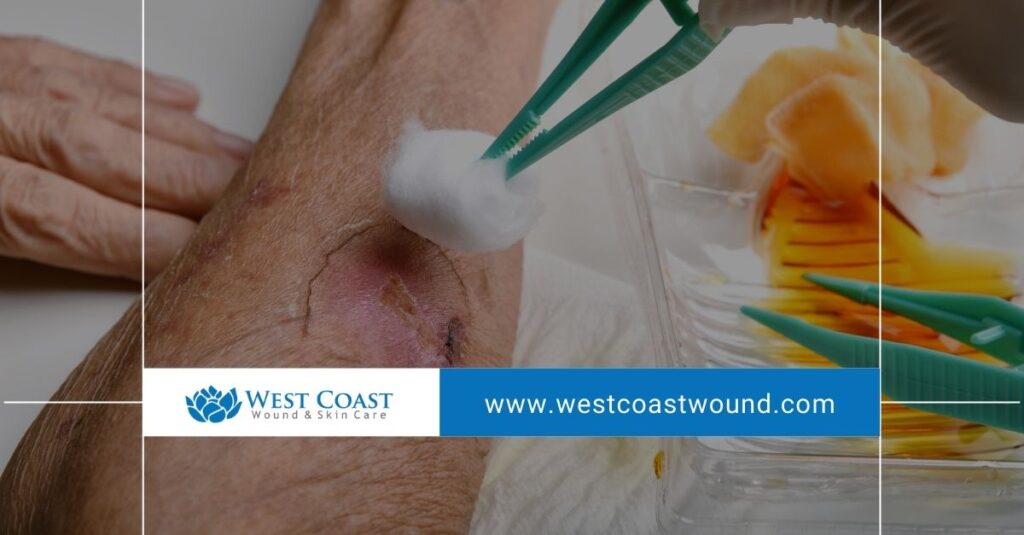 Advanced wound care