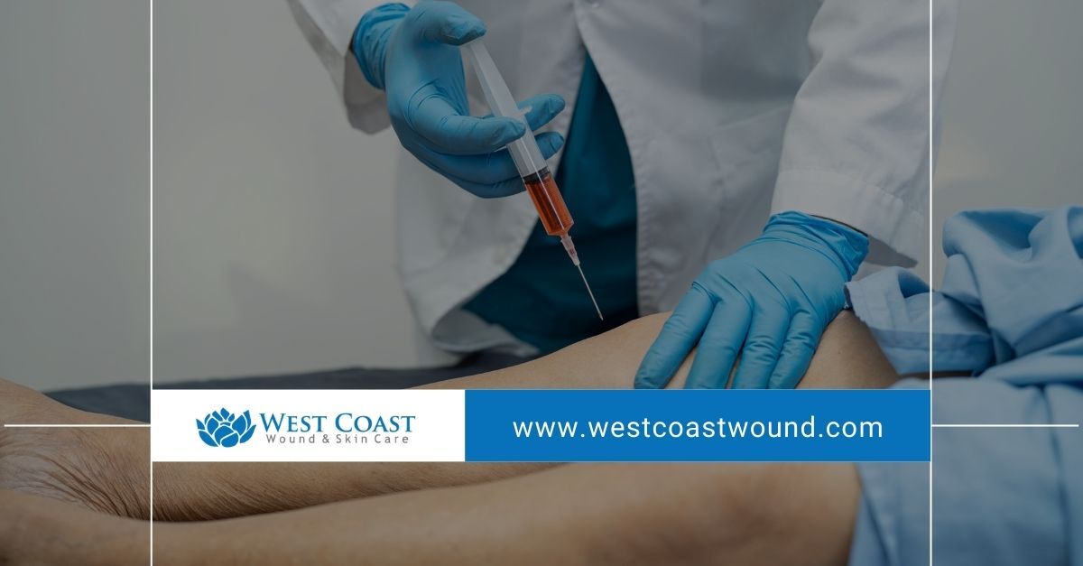 Platelet-Rich Plasma Platelet-Rich Plasma