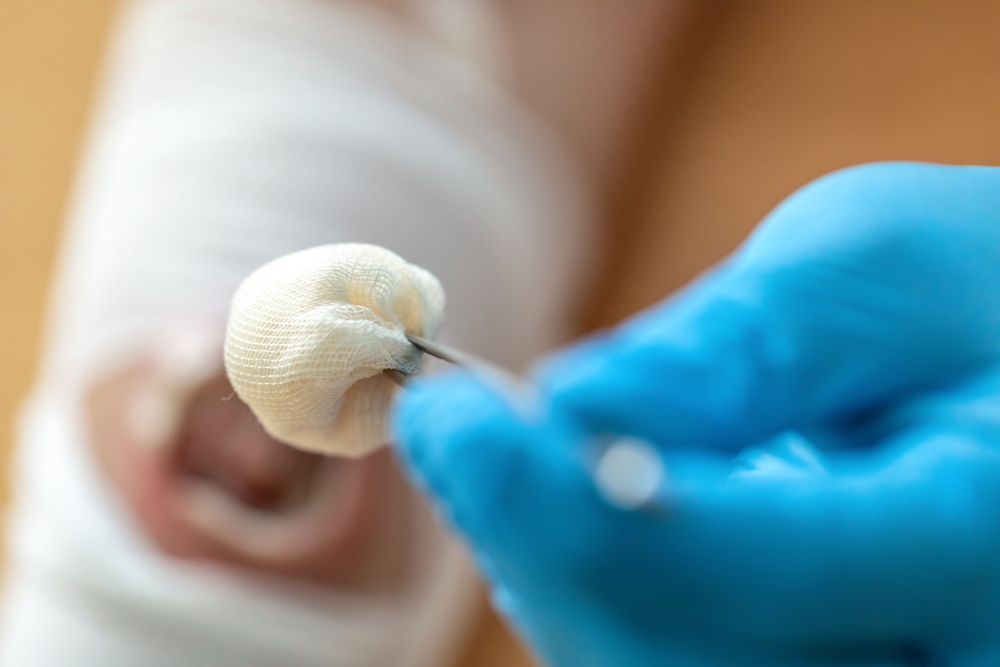 Advanced wound dressings