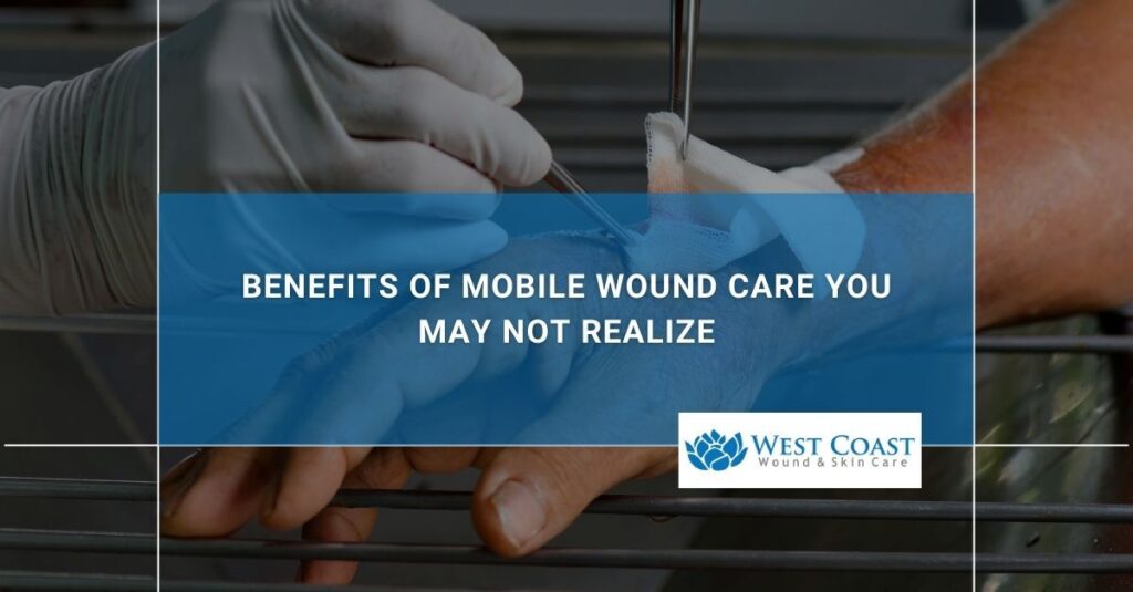 Benefits of Mobile Wound Care