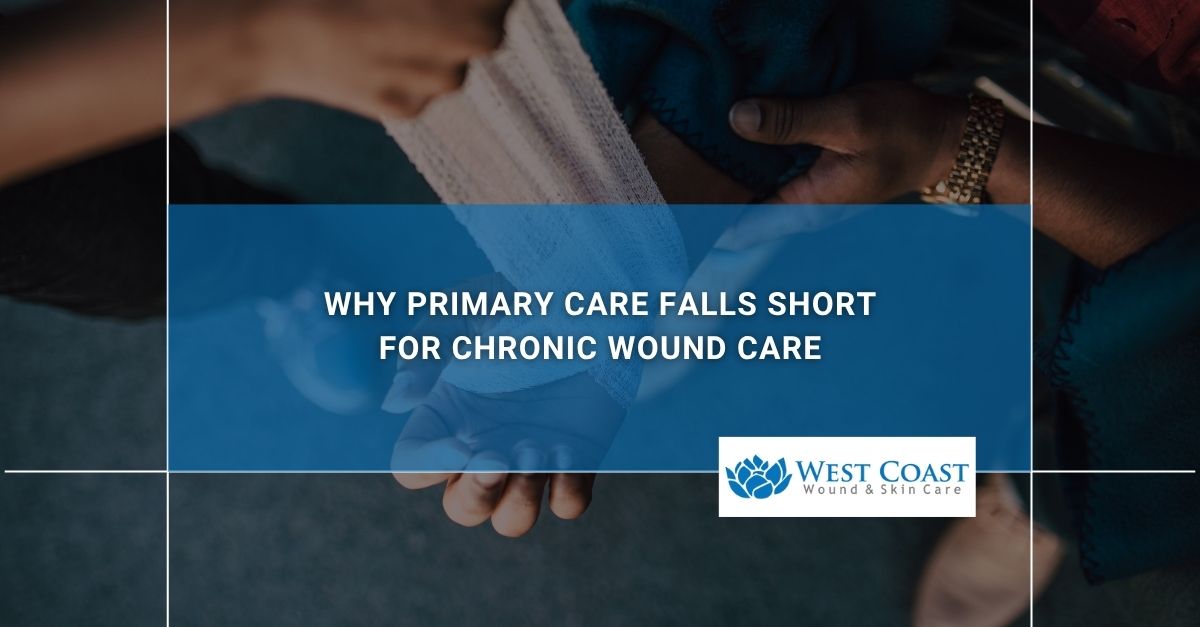 managing chronic wounds